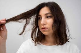 It's Linked: PCOS - Oily Scalp - Dandruff